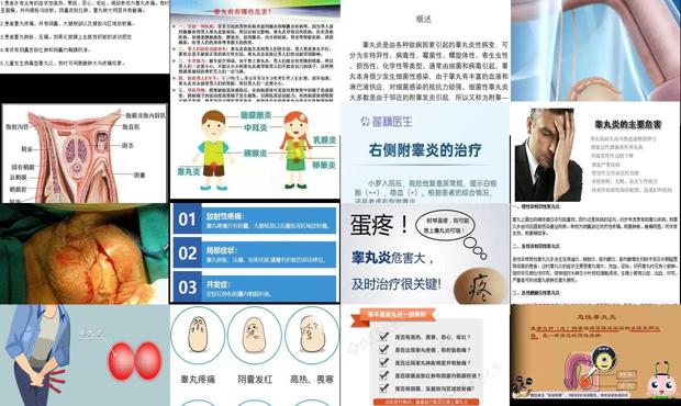 汕头睾丸炎症状