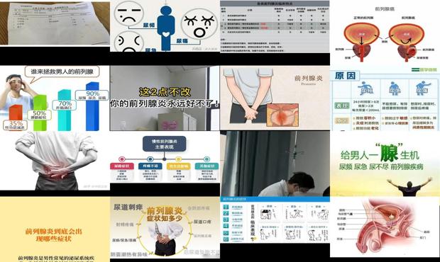 汕头前列腺炎症状推荐泌尿科咨询