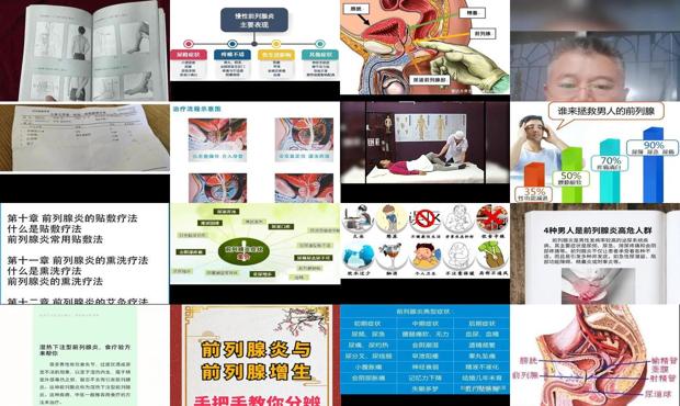 汕头前列腺炎症状自我疗法
