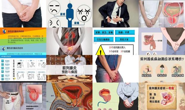 汕头前列腺炎症状表现