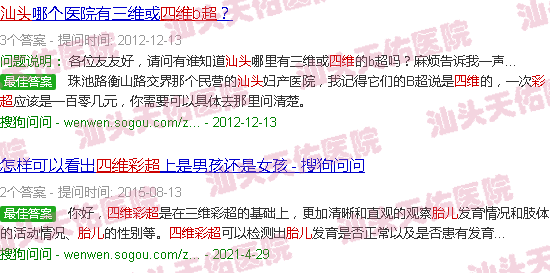 汕头四维彩超看胎儿