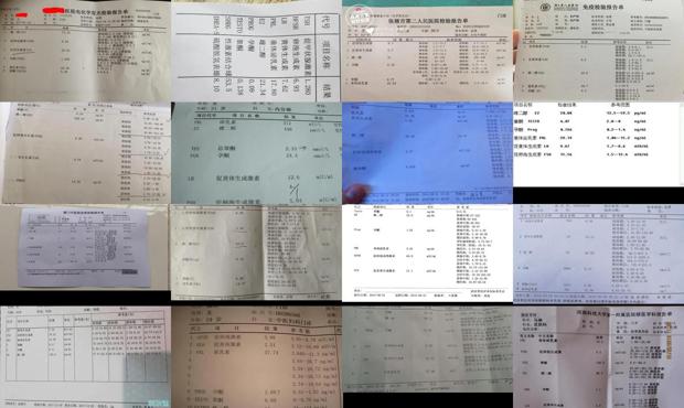 汕头性激素六项的检查