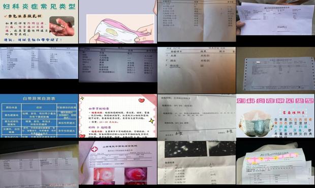 汕头怎么检查白带