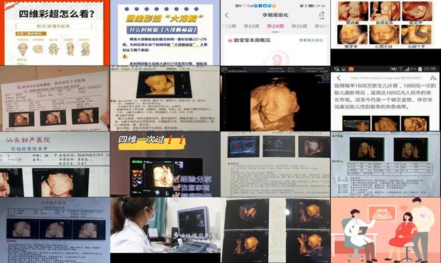 汕头四维彩超的*佳时间