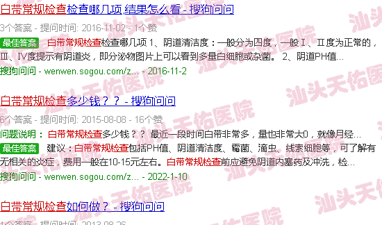 汕头白带常规检查