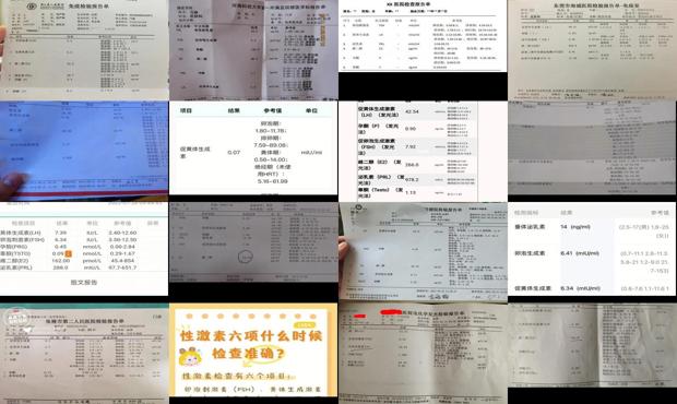 汕头激素六项检查是什么