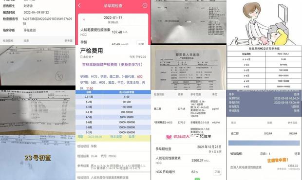 汕头hcg检查多少钱