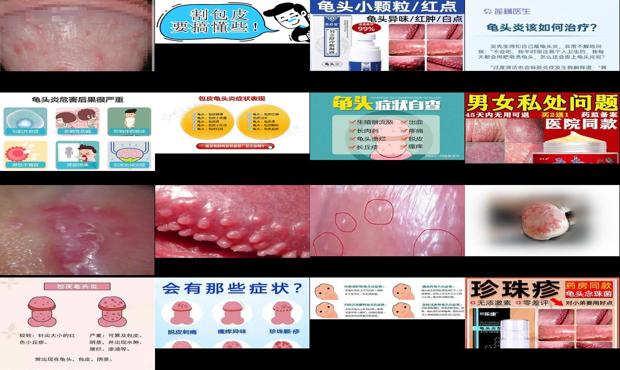 汕头包皮炎症