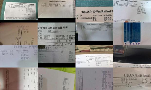 汕头血hcg检查