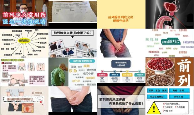 汕头前列腺炎症状是什么