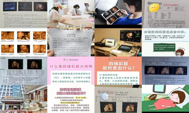 汕头四维彩超什么时候做