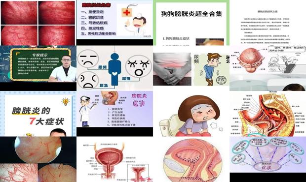 汕头膀胱炎症状