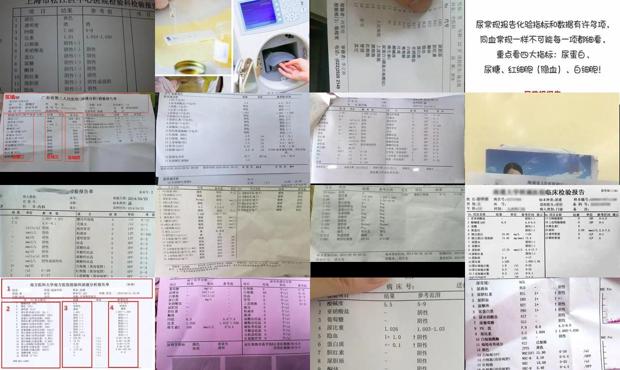 汕头尿常规主要检查什么