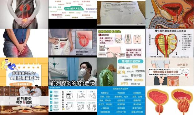 汕头前列腺炎症状表现哪些