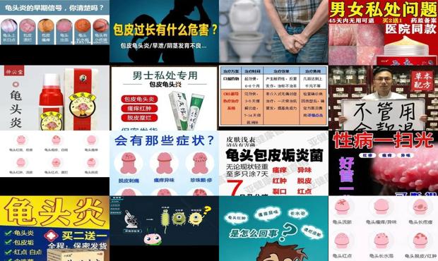 汕头龟头有炎症怎么治疗