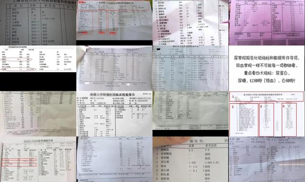 汕头尿常规能检查出什么
