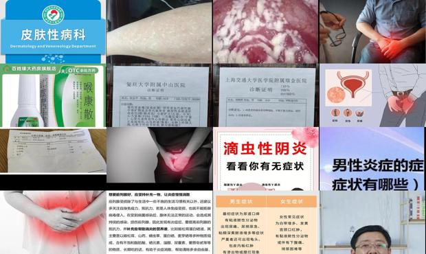 汕头男人炎症症状