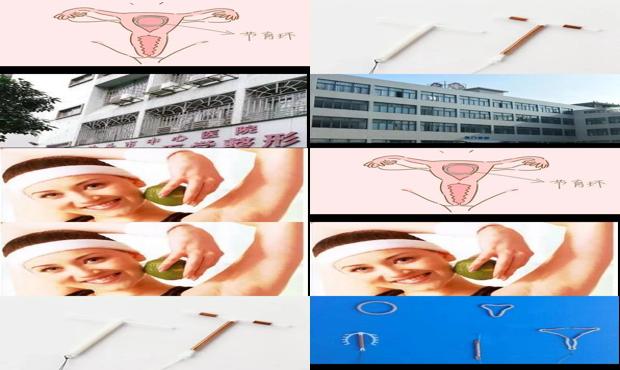 汕头上环哪里好