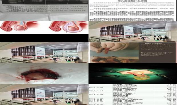 汕头孕检都检查什么