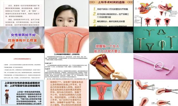 汕头上环汕头上环对身体有什么影响