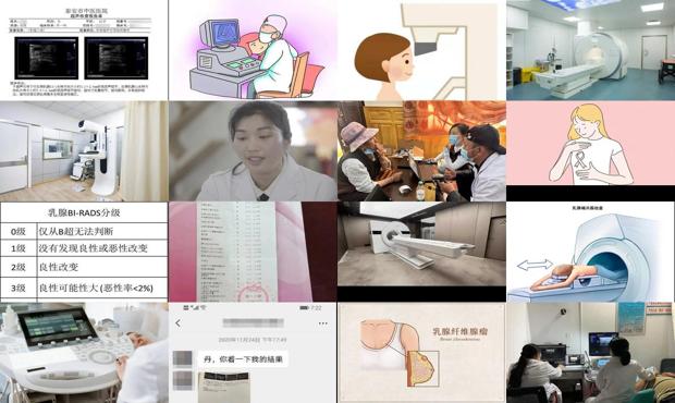 汕头乳腺b超检查多少钱