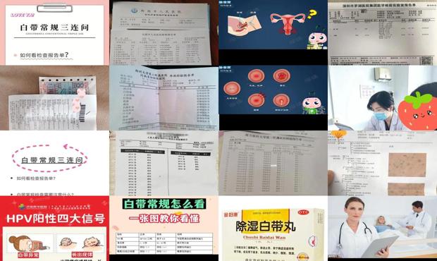 汕头白带检查多少钱