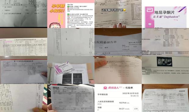 汕头孕酮是检查什么的