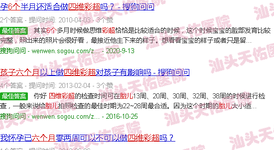 汕头胎儿6个月四维彩超