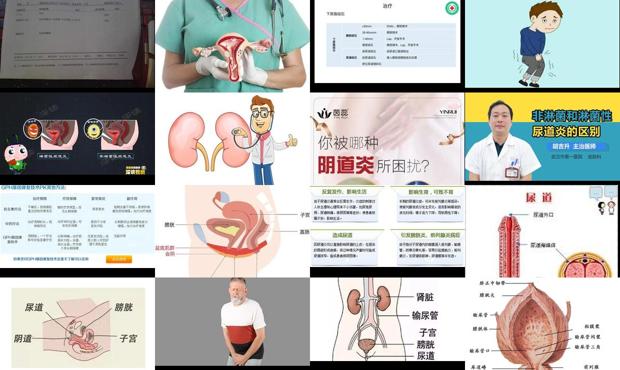 汕头尿道炎症如何治疗