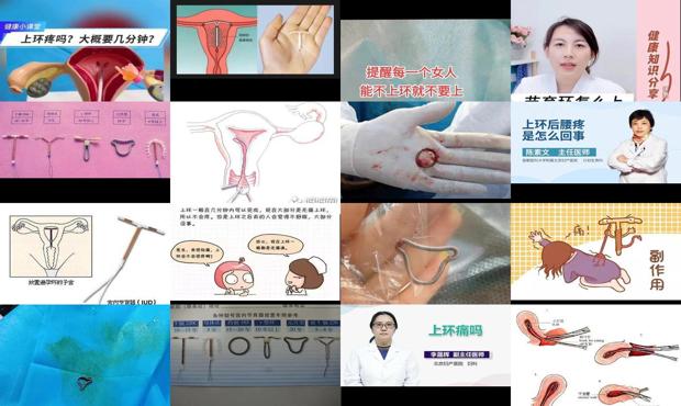 汕头上环会痛吗