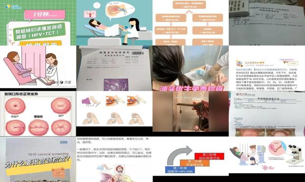 汕头如何检查宫颈