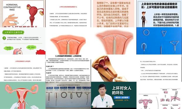 汕头上环的坏处