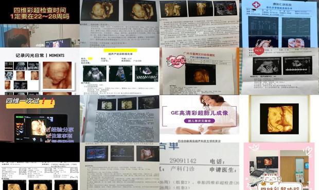 汕头四维彩超多少周做好