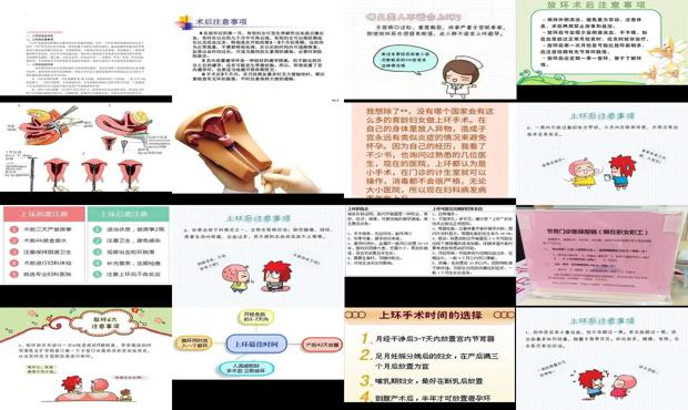 汕头女人上环后注意事项