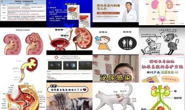 汕头泌尿系统炎症怎么办