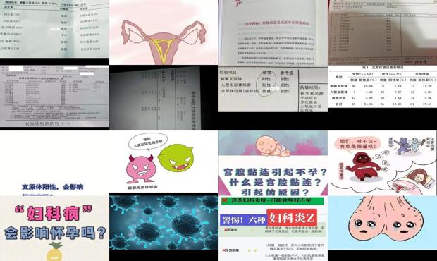 汕头支原体会引起不孕吗