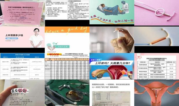 汕头上环需要多少钱