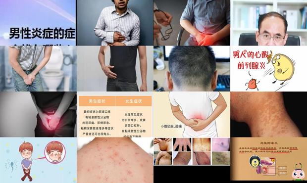 汕头男人炎症什么症状