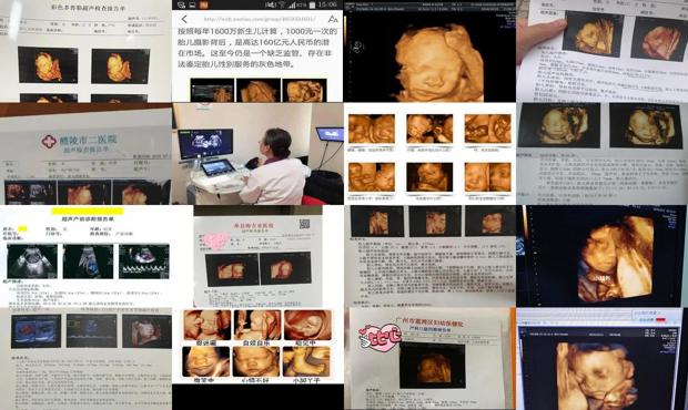 汕头孕妇几周做四维