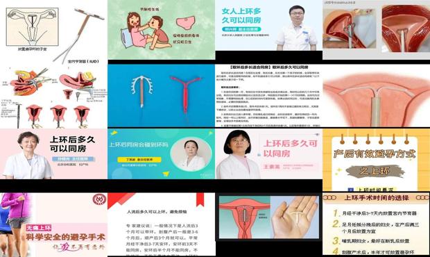 汕头同房后可以上环吗