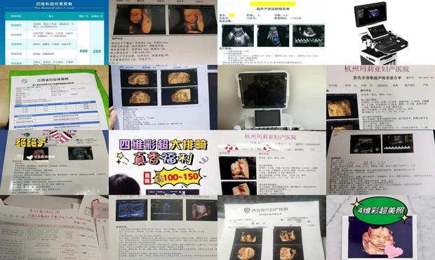 汕头四维彩超价格