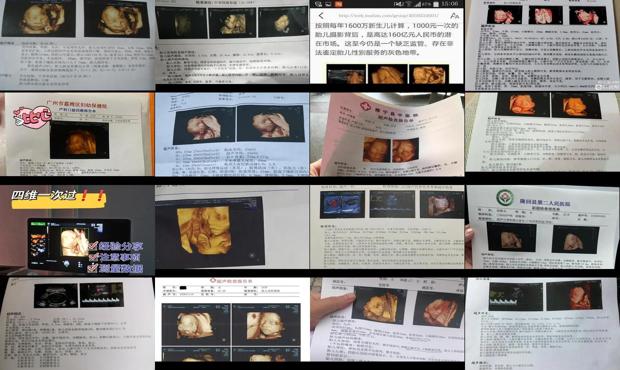 汕头四维彩超几个月*合适