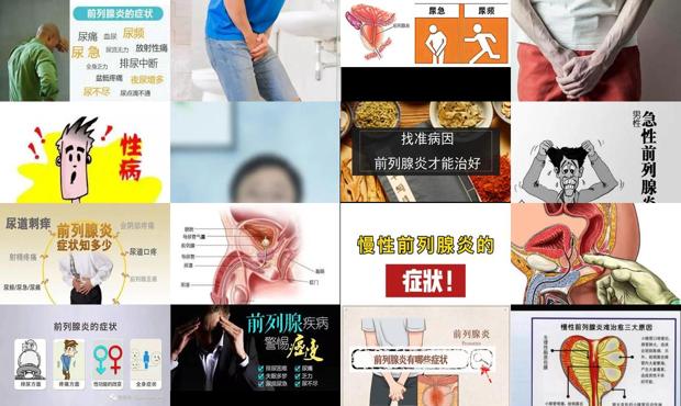 汕头慢性前列腺炎症状表现