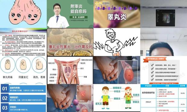汕头睾丸炎症状能自愈吗