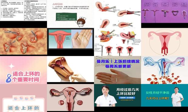 汕头月经干净后几天可以上环