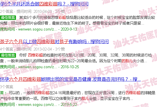 汕头六个月的胎儿四维彩超