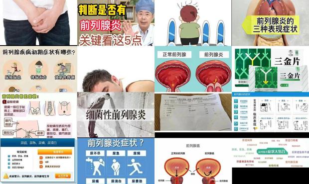 汕头急性前列腺炎症状是什么表现