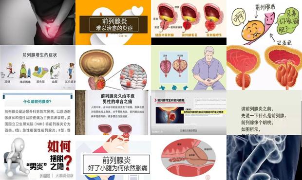 汕头什么是前列腺炎症