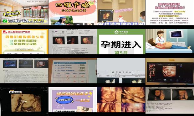 汕头一般做四维彩超多少钱
