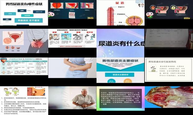汕头尿道炎症状如何治疗